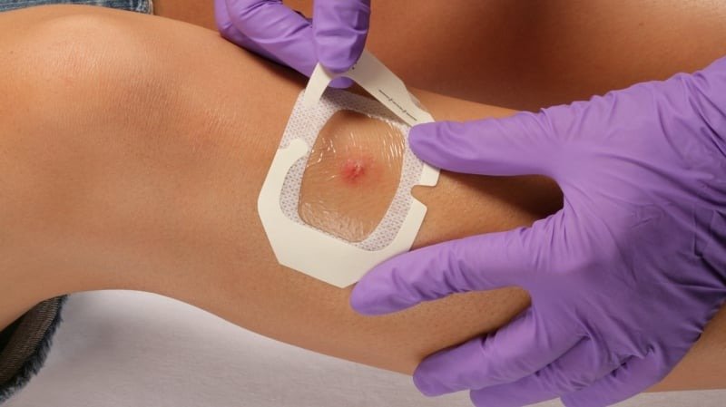 Application pSA for medical